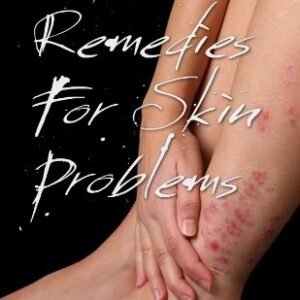 Natural Remedies For Skin Problems (English Edition) - Shelton, C.D. (CDs)