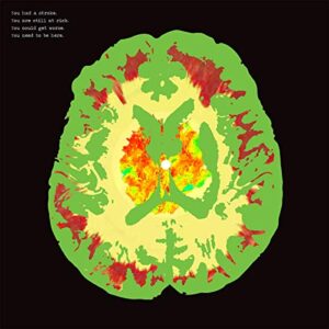 Stroke Manor - MINUS 5 (CDs)